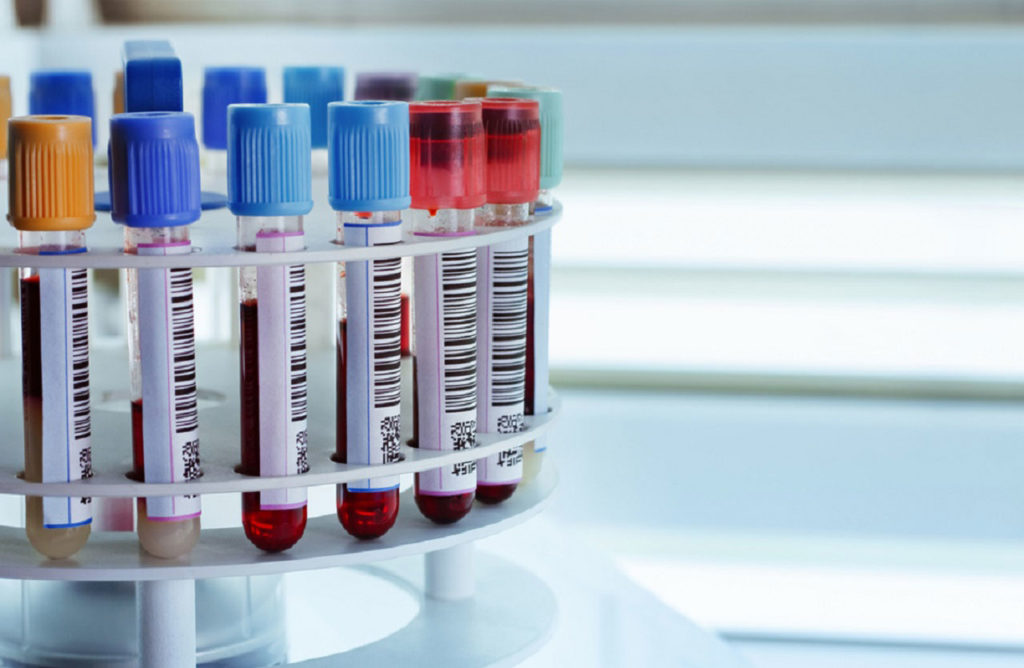 STEROID-HORMONES-SERUM